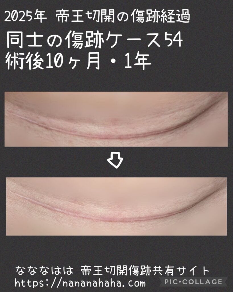 同士の傷跡54・10ヶ月・1年