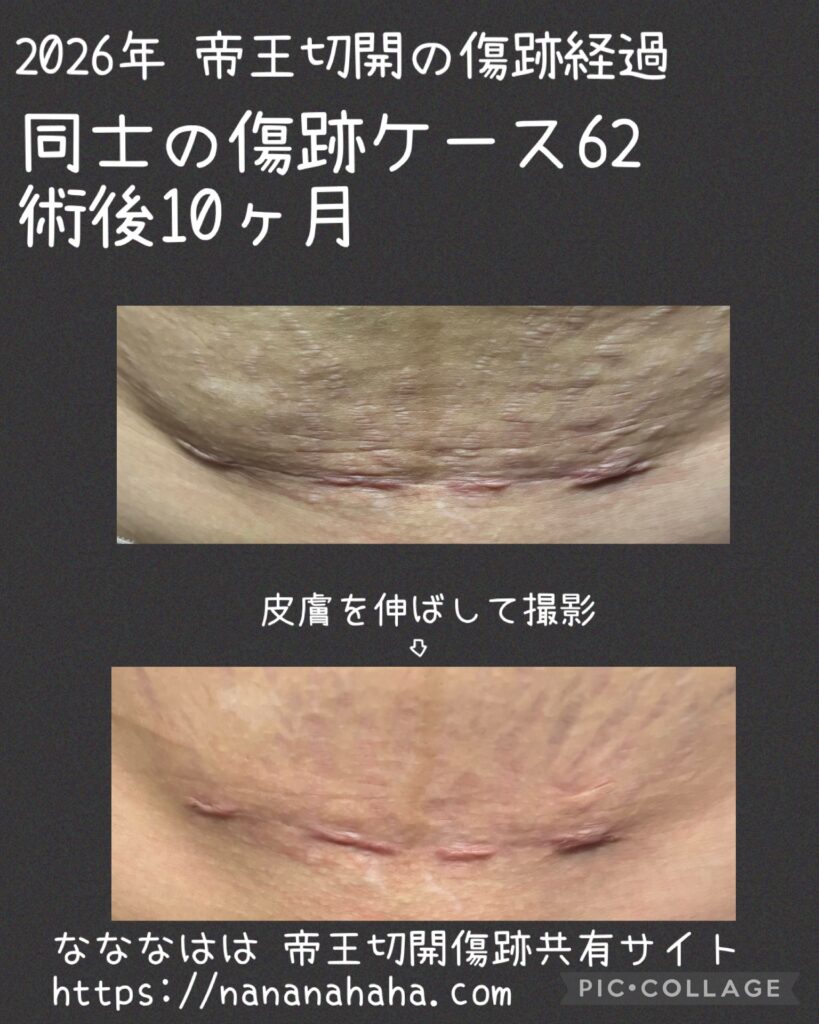 同士の傷跡62・10ヶ月