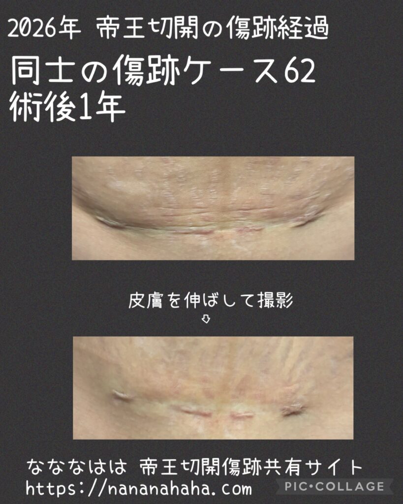 同士の傷跡62・1年