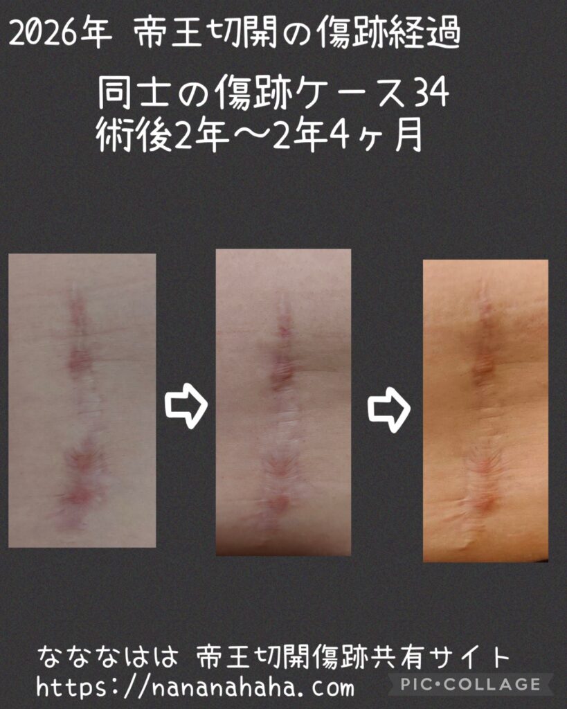 同士の傷跡34・2年～2年4ヶ月