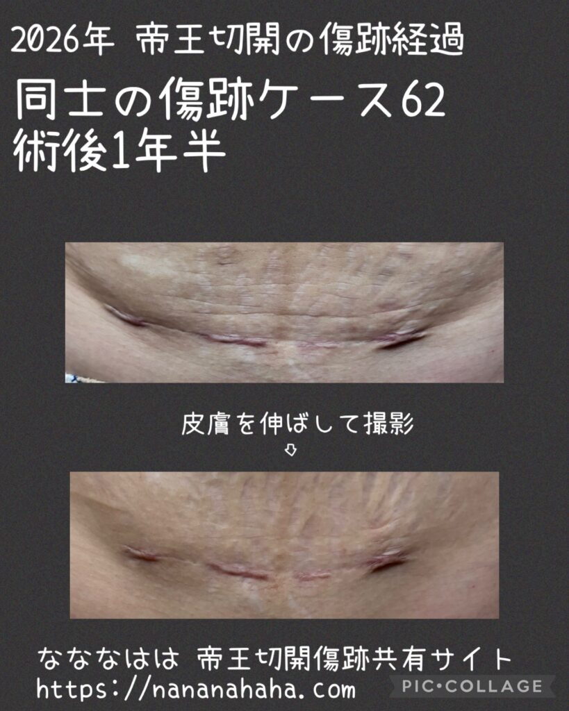 同士の傷跡62・1年半