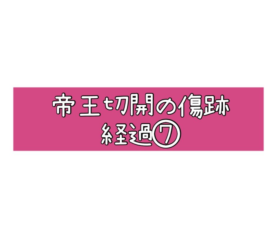 帝王切開の傷跡・経過⑦7～8ヶ月