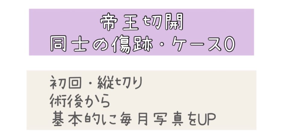 帝王切開の傷跡ケース0