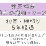 同士の傷跡ケース8表紙