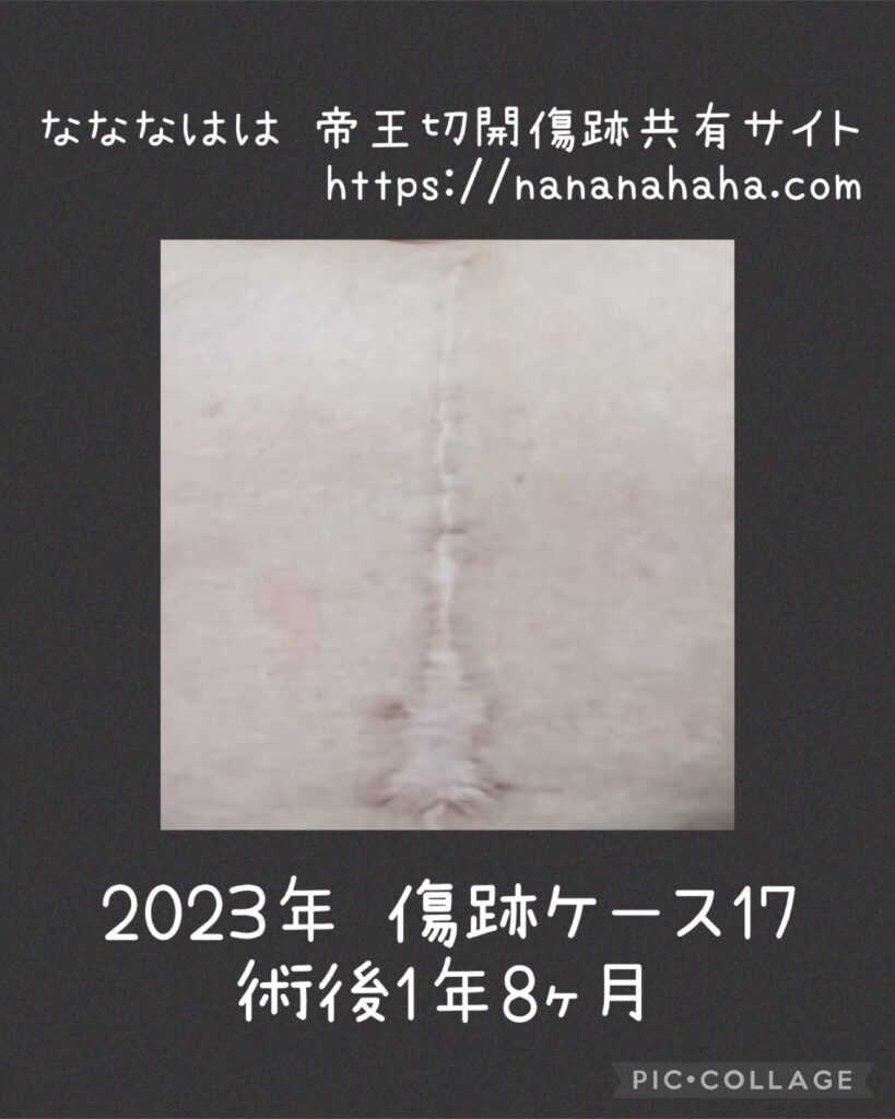 同士の傷跡ケース17・1年8ヶ月