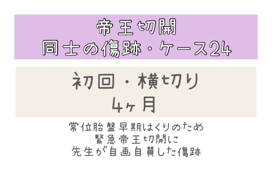 同士の傷跡24・4ヶ月