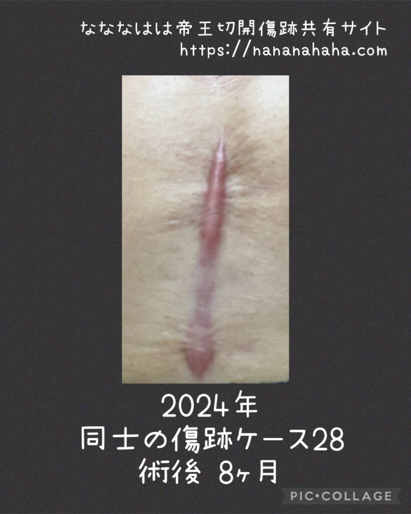 同士の傷跡28・8ヶ月