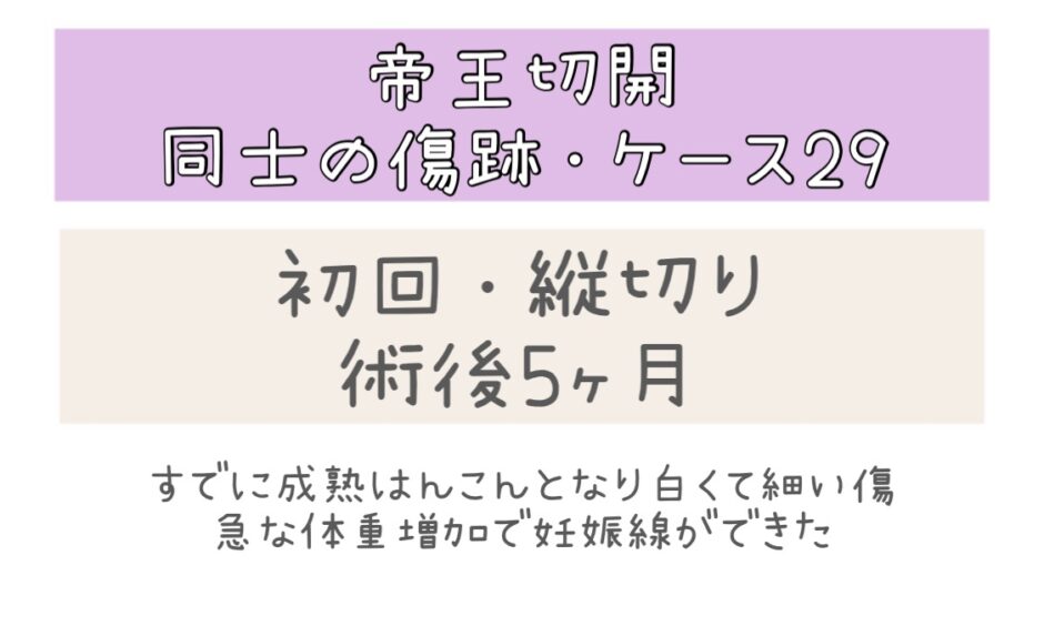 同士の傷跡29・5ヶ月