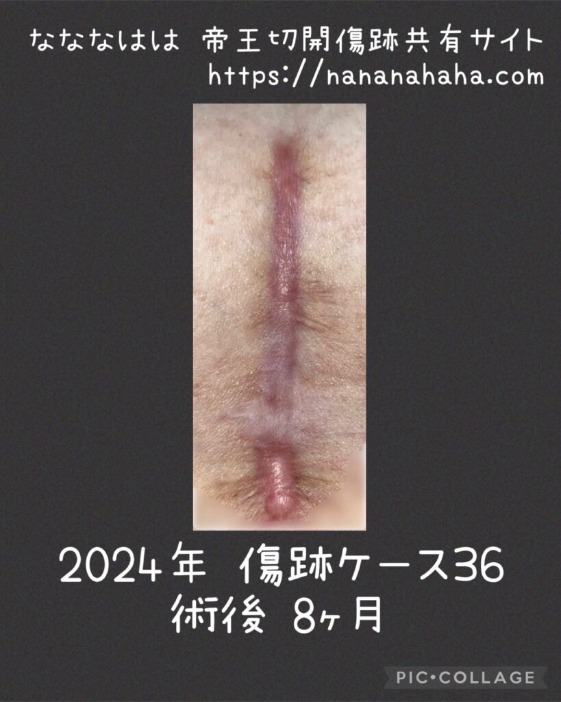 同士の傷跡13・8ヶ月