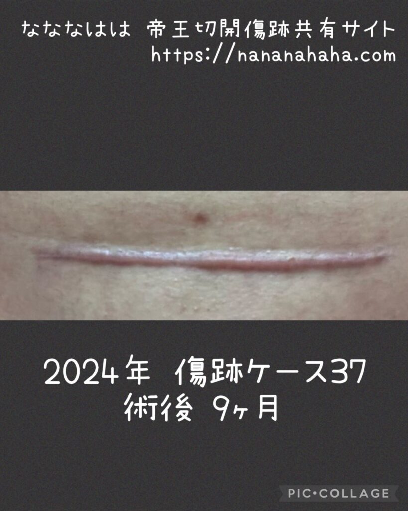 同士の傷跡37・9ヶ月