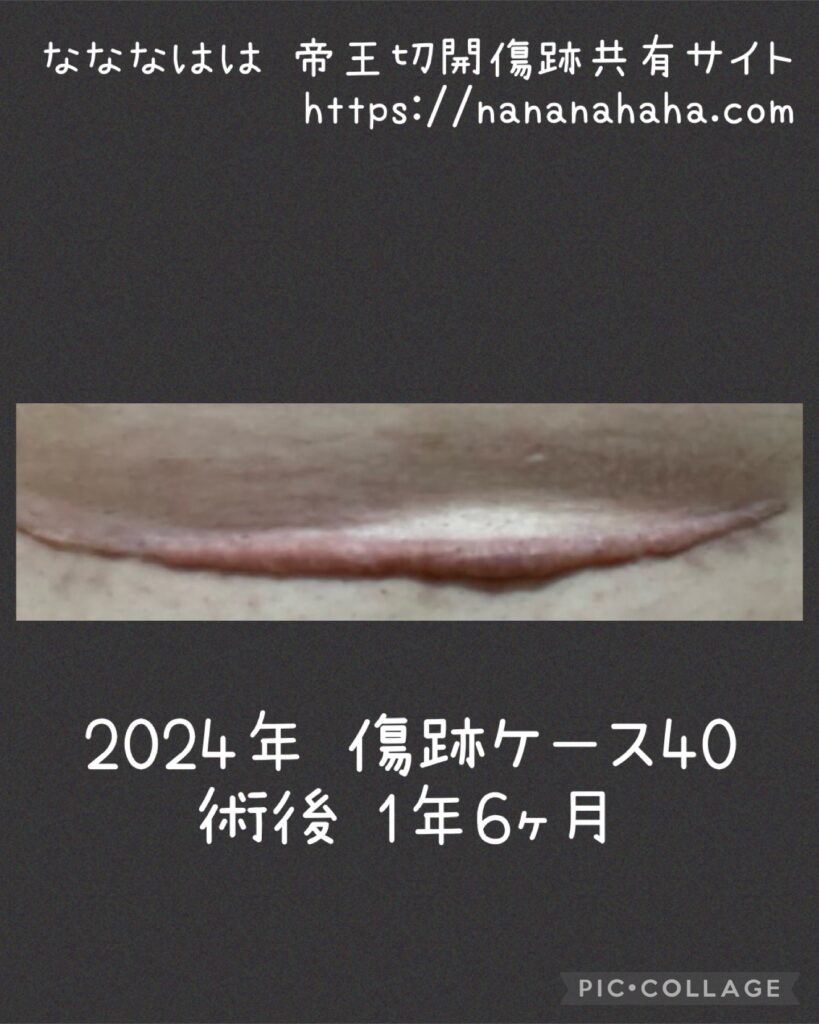 同士の傷跡40・1年6ヶ月