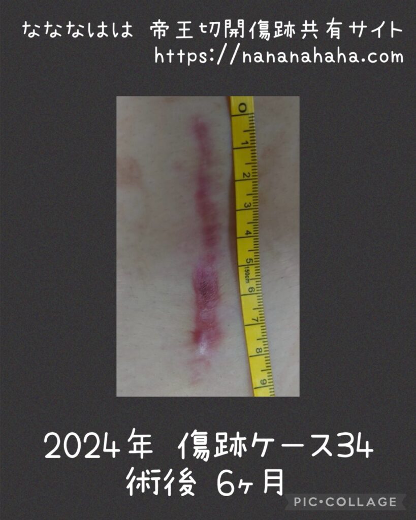 同士の傷跡34・6ヶ月