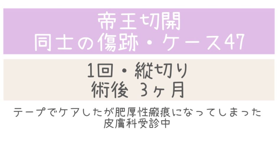 同士の傷跡47・3ヶ月