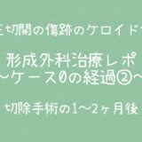 治療ケース0・経過②2ヶ月