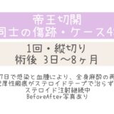 同士の傷跡48・3日～8ヶ月