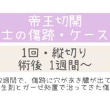 同士の傷跡49・1～5週間