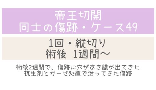 同士の傷跡49・1～5週間