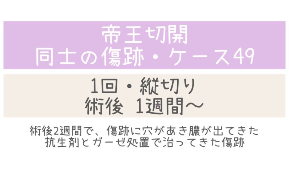 同士の傷跡49・1～5週間