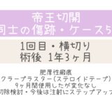 同士の傷跡53・1年3ヶ月