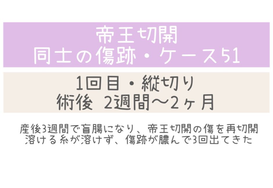 同士の傷跡51・2週間～2ヶ月