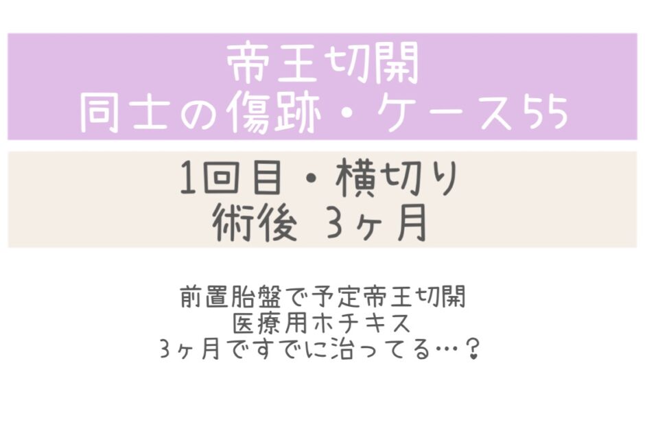 同士の傷跡55・3ヶ月