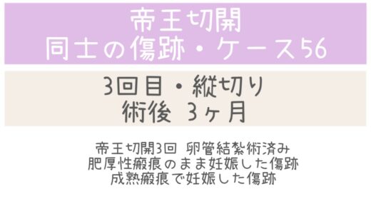 同士の傷跡56・2ヶ月、妊娠中の傷跡あり