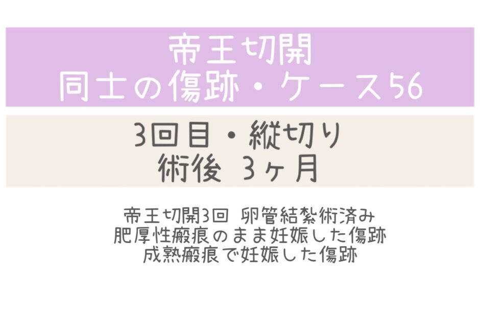 同士の傷跡56・2ヶ月、妊娠中の傷跡あり