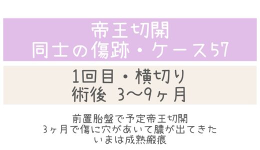 同士の傷跡57・3～9ヶ月