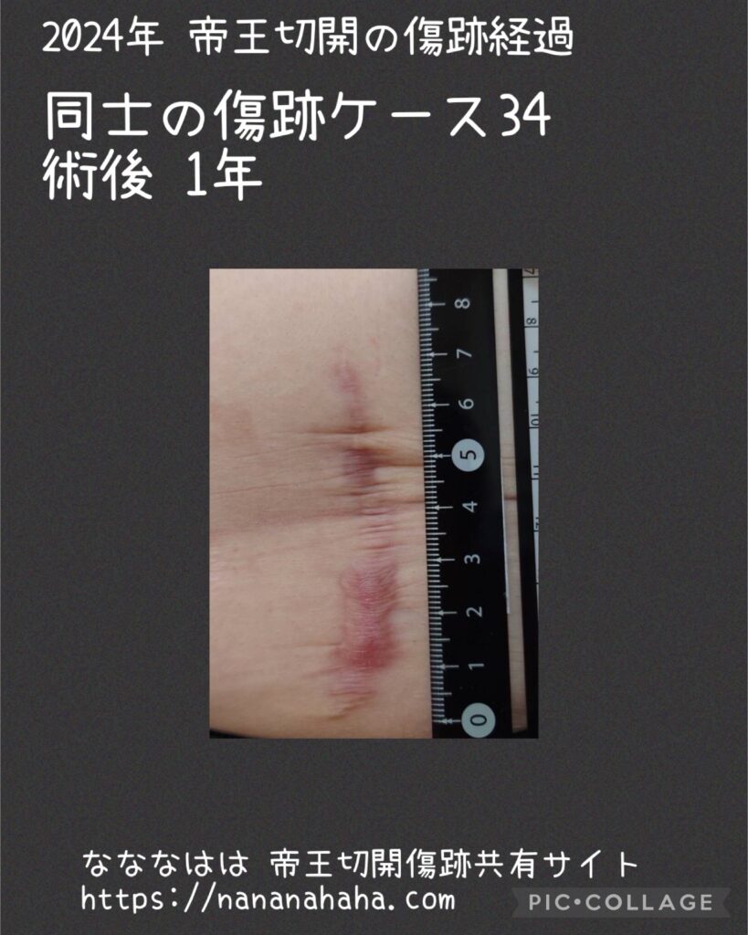 同士の傷跡34・1年