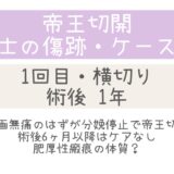 同士の傷跡59・1年