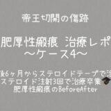 治療ケース4・1年7ヶ月注射3回