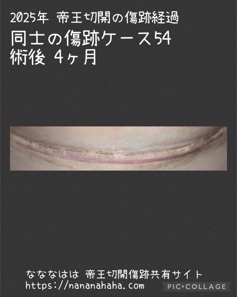 同士の傷跡54・4ヶ月