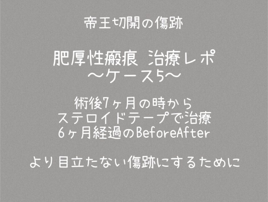 治療ケース5・1年1ヶ月(同士35)より目立たなく