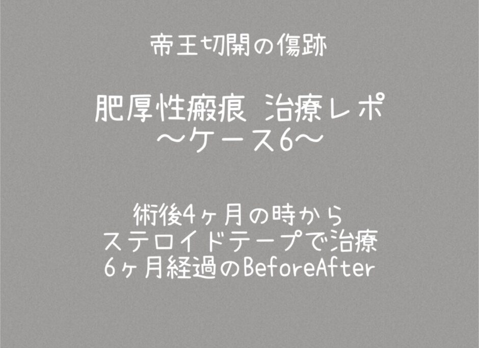 治療ケース6・1年1ヶ月(同士44)