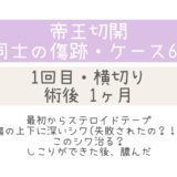 同士の傷跡62・シワが深い・膿んだ