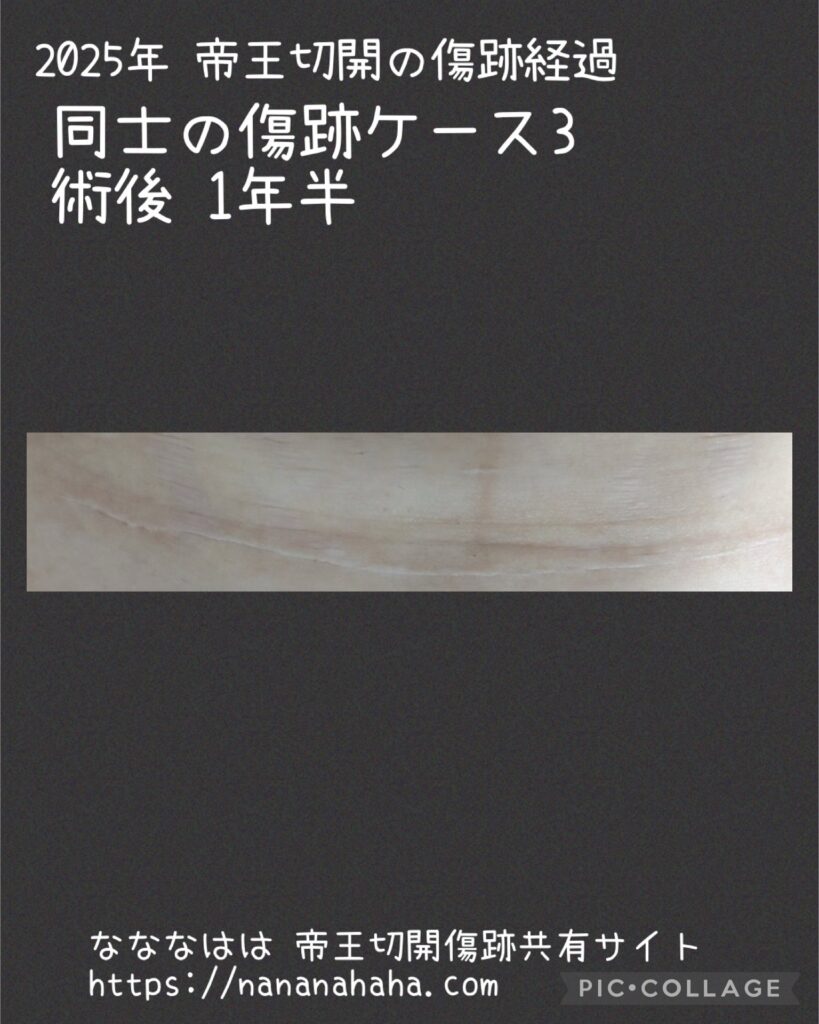同士の傷跡3・1年半