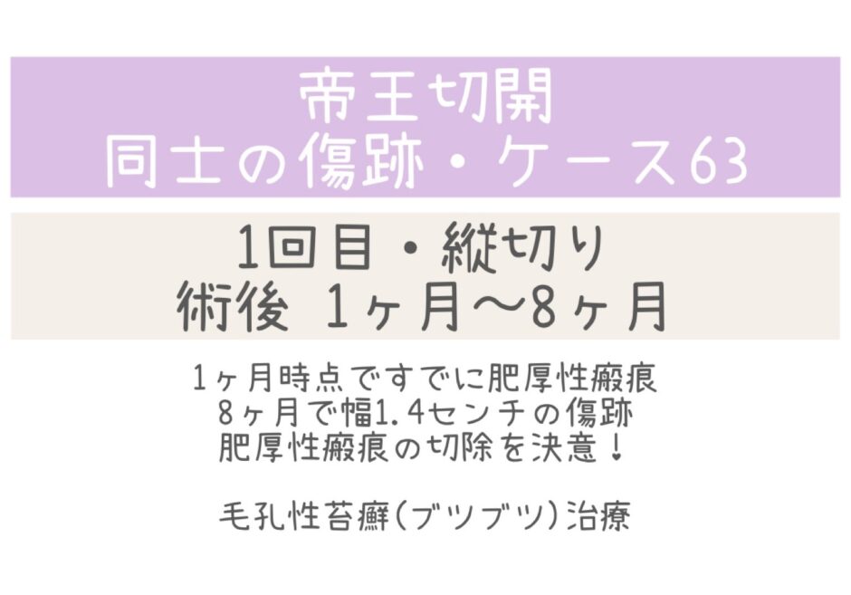 同士の傷跡63・1～8ヶ月