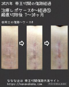 治療ケース0・経過⑤7~10ヶ月