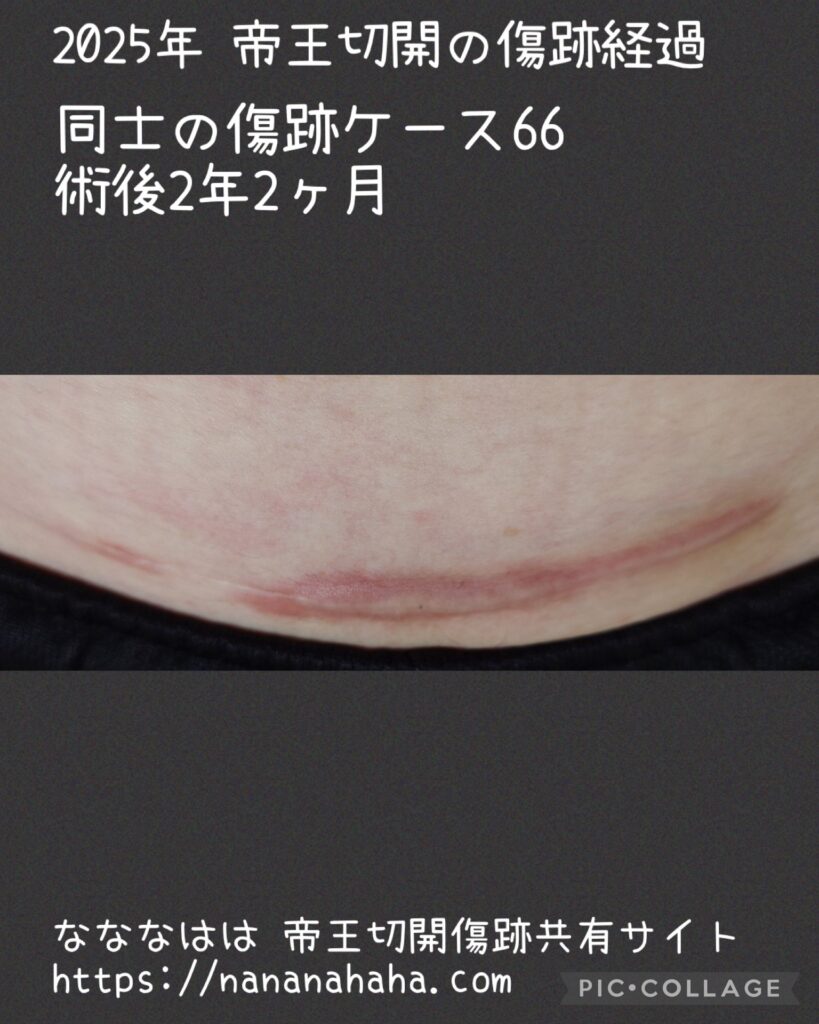 同士の傷跡66・2年2ヶ月