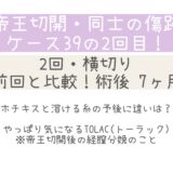同士の傷跡39の2回目・7ヶ月