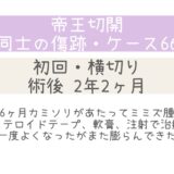 同士の傷跡66・2年2ヶ月・治療後膨らんだ