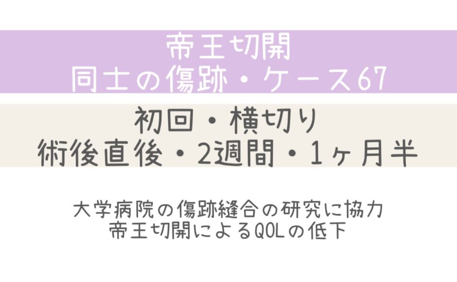 同士の傷跡67・大学病院の研究に協力 ・QOLの低下