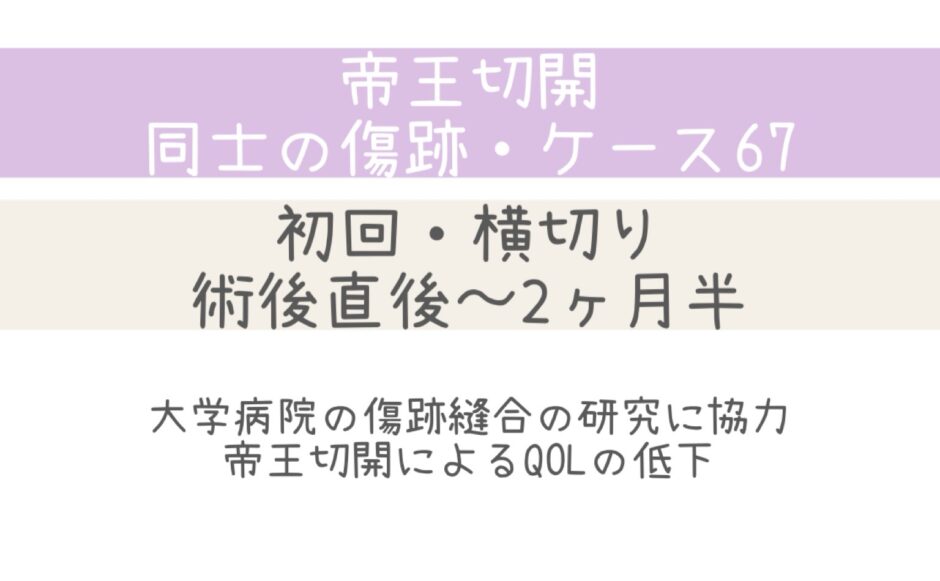 同士の傷跡67・大学病院の研究に協力 ・QOLの低下