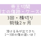同士の傷跡68・術後2ヶ月