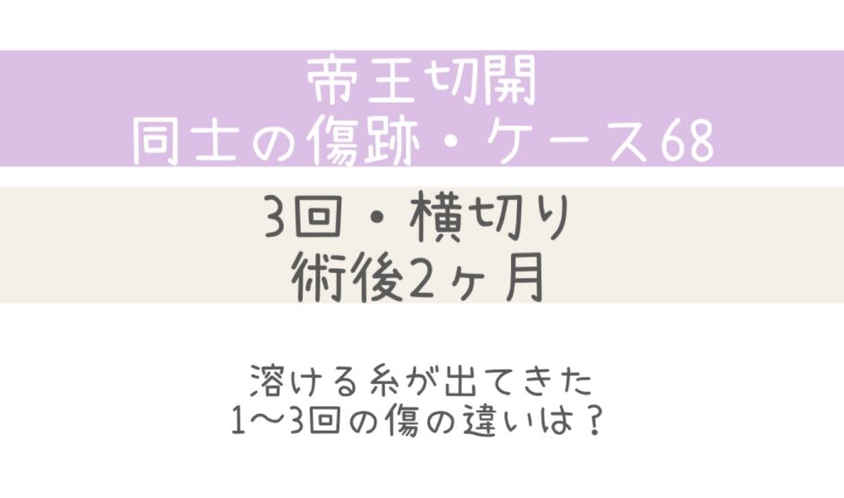 同士の傷跡68・術後2ヶ月