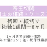同士の傷跡70・術後1週間～8ヶ月半